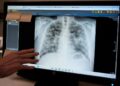 Webinar to examine air quality and its impact on lung health to be held on November 23